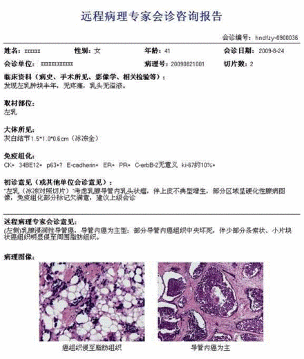 病理诊断报告