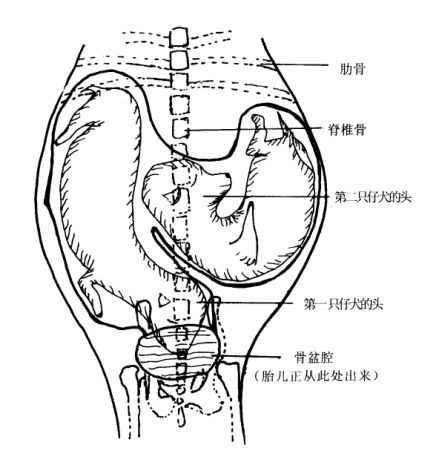 怀孕末期的X光图片