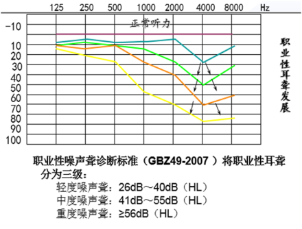 职业性耳聋发展情况