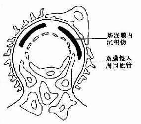 肾小球