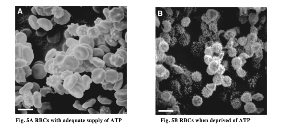 红细胞在ATP充足/缺乏时的不同形态 
