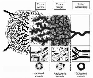 肿瘤血管
