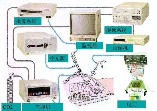 图1 腹腔镜组成示意图