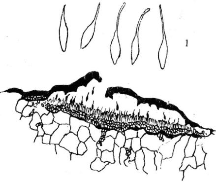 分生孢子座