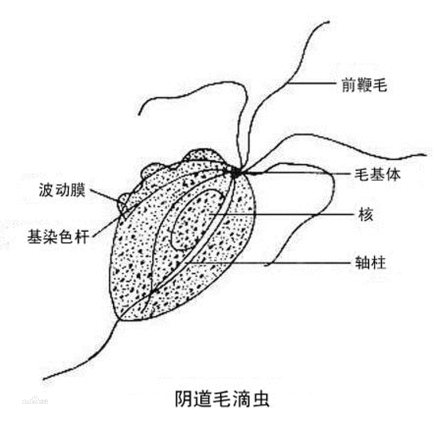 阴道毛滴虫